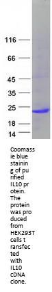 IL10 (NM_000572) Human Recombinant Protein
