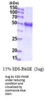 Human Glucuronosyltransferase 1A1/UGT1A1 Recombinant Protein