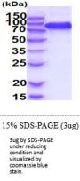 Human FGF R3 Recombinant Protein