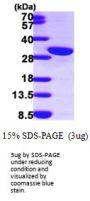 Human Calretinin/CALB2 Recombinant Protein