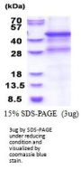 Human MMP8 Recombinant Protein