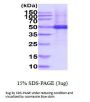 Human TUBG1 Recombinant Protein