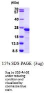 Human MYL9 Recombinant Protein