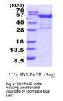 Human BRD2 Recombinant Protein