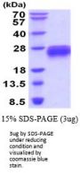 Human Fas/TNFRSF6/CD95 Recombinant Protein
