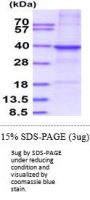 Human Cathepsin S Recombinant Protein