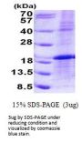 Human LMO1 Recombinant Protein