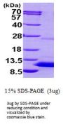 Human S100P Recombinant Protein