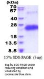 Human CD40/TNFRSF5 Recombinant Protein