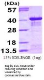 Human IkB-alpha Recombinant Protein