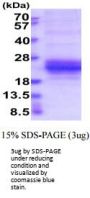 Human KLRC1 Recombinant Protein