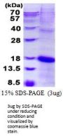 Human KLRC2 Recombinant Protein