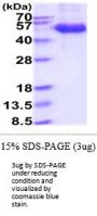 Human NKG2D Recombinant Protein