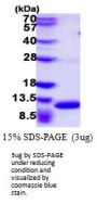 Mouse S100A8 Recombinant Protein