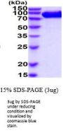 Human DPP4/CD26 Recombinant Protein