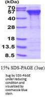 Human Calreticulin Recombinant Protein
