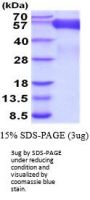 Human CD30/TNFRSF8 Recombinant Protein