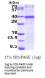 Human CTGF/CCN2 Recombinant Protein