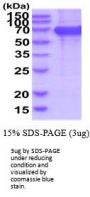 Human EphB2 Recombinant Protein