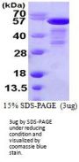 Human SHC1 Recombinant Protein