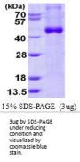 Human IL-12B/IL-12 p40 Recombinant Protein