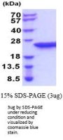 Rat Lipocalin-2/NGAL Recombinant Protein