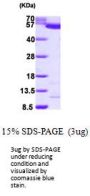 Human PKLR Recombinant Protein