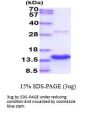 Human S100A7 Recombinant Protein
