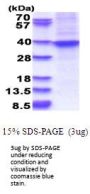 Human HOXA9 Recombinant Protein