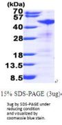 Human RRM2 Recombinant Protein
