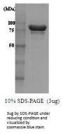 Yeast Hsp104 Recombinant Protein