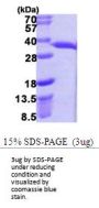 e.coli hchA Recombinant Protein