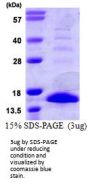 Mouse S100A9 Recombinant Protein