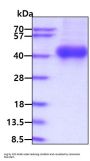 Human Common gamma/IL-2RG Recombinant Protein