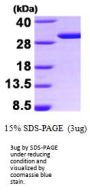 Human 14-3-3 sigma Recombinant Protein