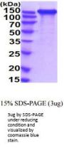 Human L1CAM Recombinant Protein