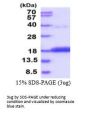 Human CDA Recombinant Protein