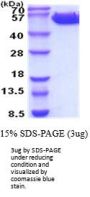 Human Common beta Chain Recombinant Protein