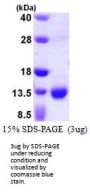 Human S100A3 Recombinant Protein