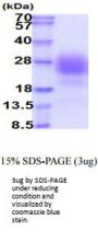Human SDC2 Recombinant Protein