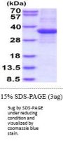 Human Prohibitin Recombinant Protein