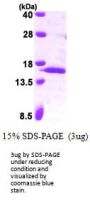 Human Serum Amyloid A4/SAA Recombinant Protein