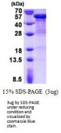 Human KRT20 Recombinant Protein