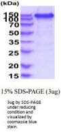 Human VEGF R2/KDR/Flk-1 Recombinant Protein
