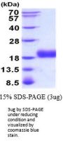 Human ALK-1 Recombinant Protein