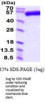 Human TGF-beta RII Recombinant Protein