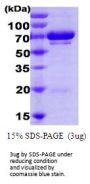 Human GRP75/HSPA9B Recombinant Protein