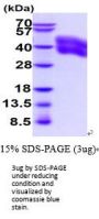 Human CEACAM-6/CD66c Recombinant Protein