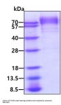 Mouse Thrombopoietin Recombinant Protein