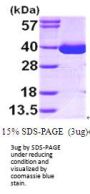Human MDH1 Recombinant Protein